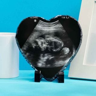 Baby-Scan-Heart-Photo-Slate-6.jpg